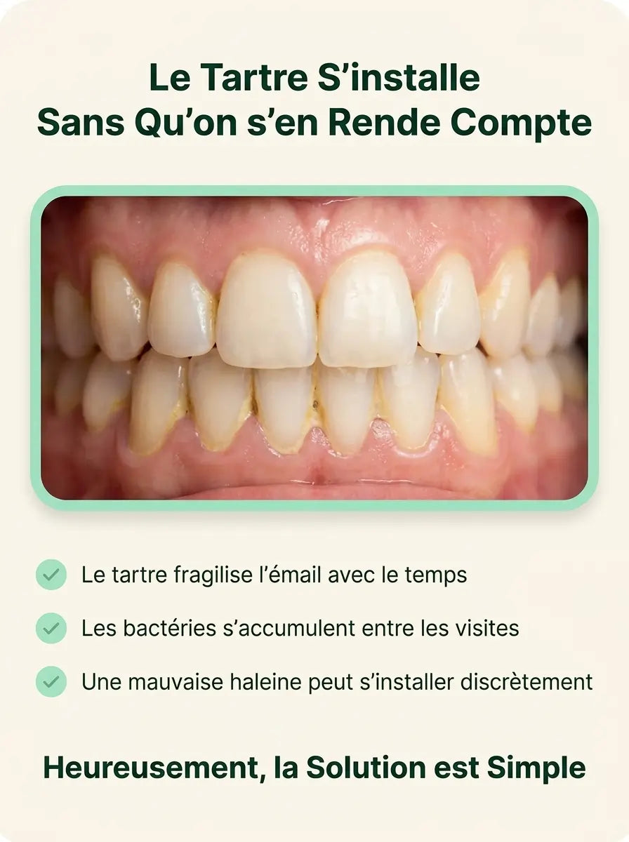 Détartreur Dentaire Électrique