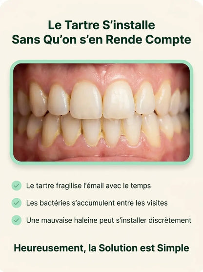Détartreur Dentaire Électrique